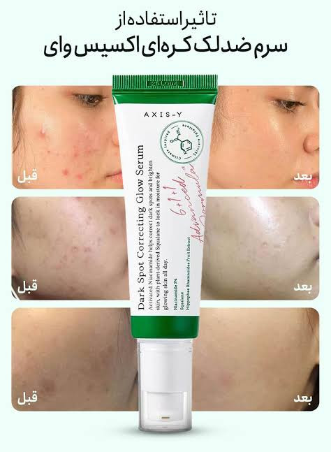 سرم ضدلک اکسیس وای اورجینال | AXIS-Y Dark Spot Correcting Glow Serum